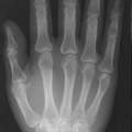 Hilfe! Hand!
