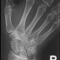 Hilfe! Hand!