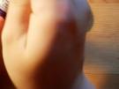 Blutzucker messen