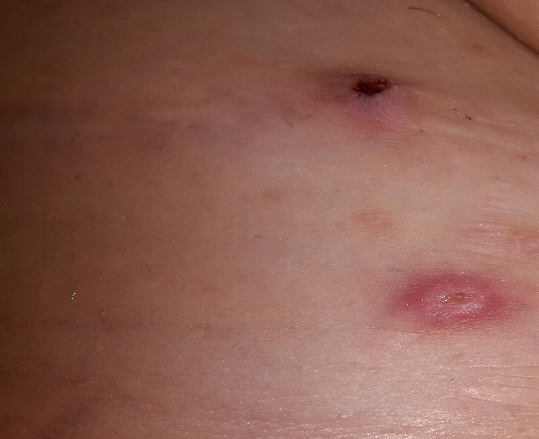 Zu welchem Arzt, mit der kleinen Brust zu gehen