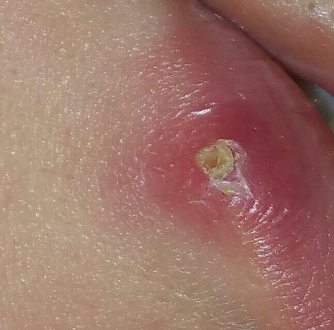 Actimaris kaufen Actimaris kaufen