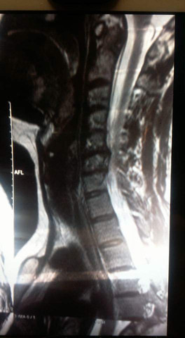 MRT - (Arzt, Gesundheit, Diagnose)