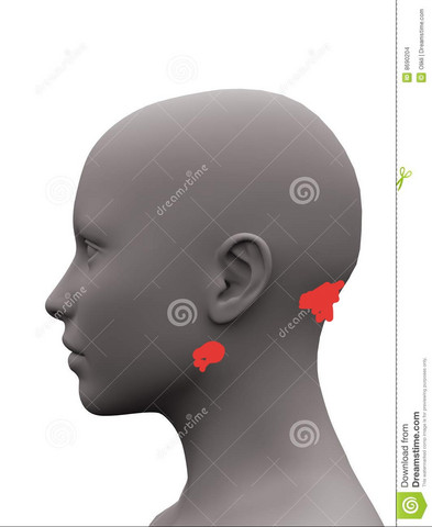 Lautes Knacken Knirschen Und Druck In Diesem Bereich Welche Knochen Sind Das Kopfgelenk Lautes Knacken Knirschen Und Druck In Diesem Bereich Welche Knochen Sind Das Kopfgelenk