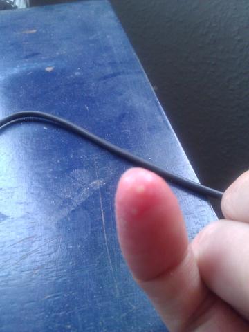 - (Haut, Finger, Pilze)