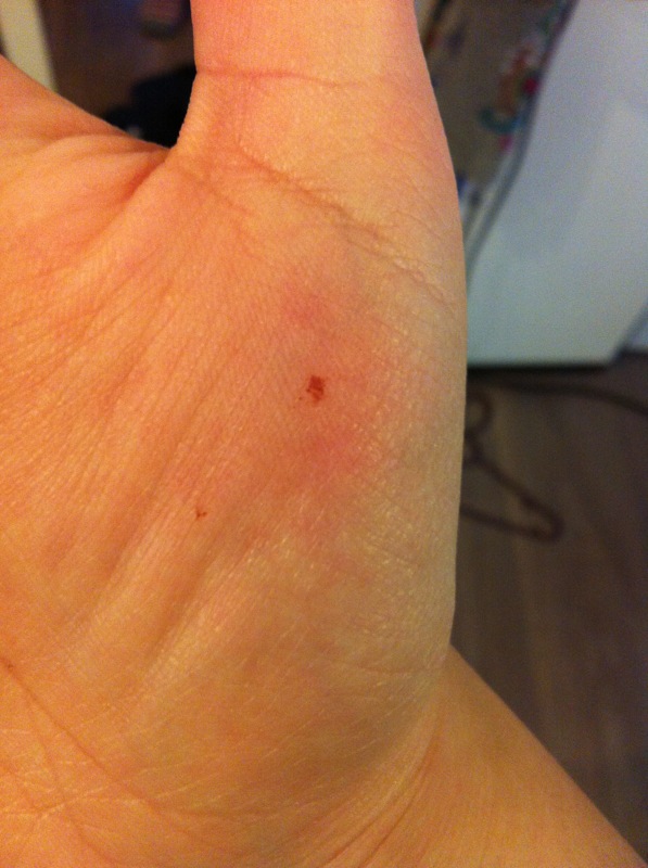 punkte auf der hand punkte auf der hand