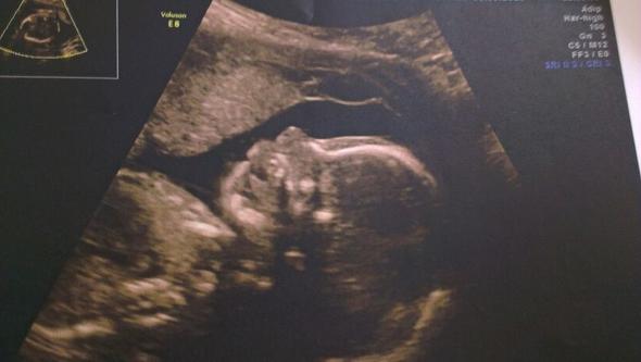 Meine Prinzessin - (Schwangerschaft, Baby, Bewegung)