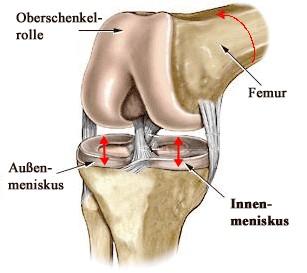 Kniedarstellung  - (Knie, MRT, Diagnose)