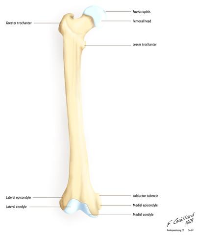 lateralen K. - (Knie, Untersuchung, Magnetresonanztomographie)