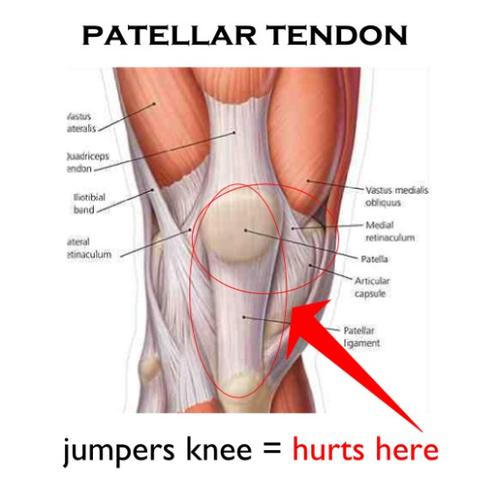 Patella - (Orthopädie, OP, Kniescheibe)