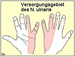 Nervus Ulnaris - (Befund, Fingerluxation)