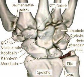 dreieckige Scheibe Diskus triangularis  - (MRT Befund, Handwurzel)