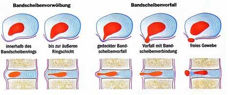 Erneuter Bsv Erneuter Bsv