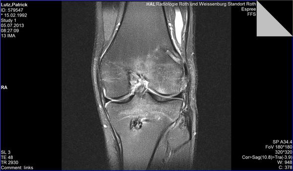 Knie 1 - (Orthopädie, Chirurgie)