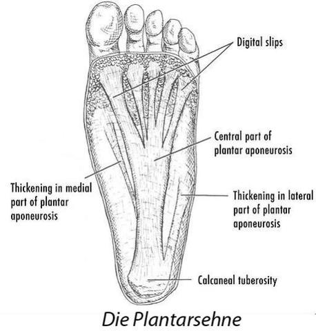 Plantarsehne - (Orthopäde, Sportverletzung, Sprunggelenk)
