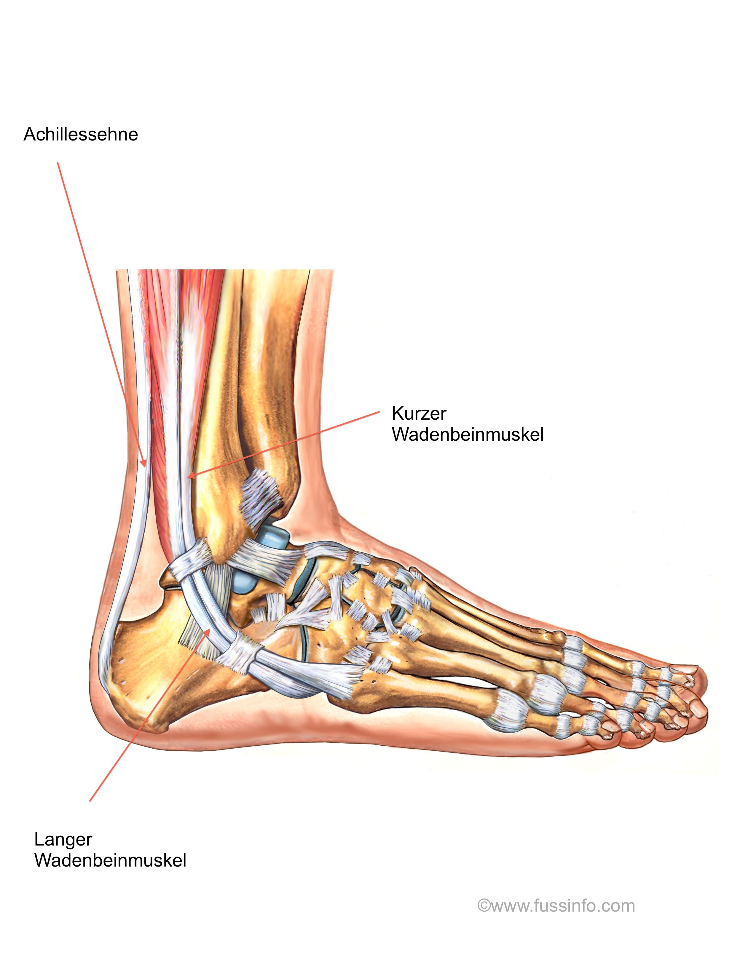 Fußverletzung (Füße, Verletzung, Knochen)
