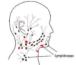 Woher kommen seit 2 Jahren geschwollene Lymphknoten (Hals, Nacken, Leiste) ohne Krankheitsgrund ...