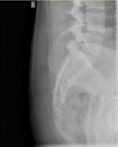 - (Schmerzen, Medizin, Orthopädie)