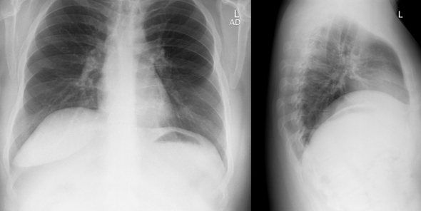 Röntgenbild - (Arzt, Lunge, Untersuchung)