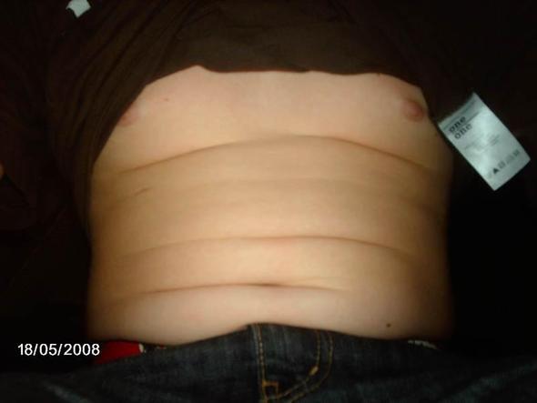 - (Bauch, fett, zu dick)