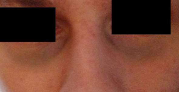 - (Haut, Augen, Behandlung)