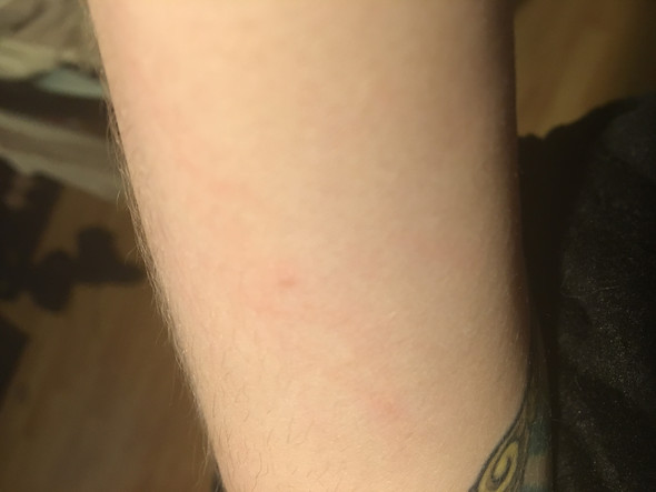 - (Haut, Allergie, Dermatologie)