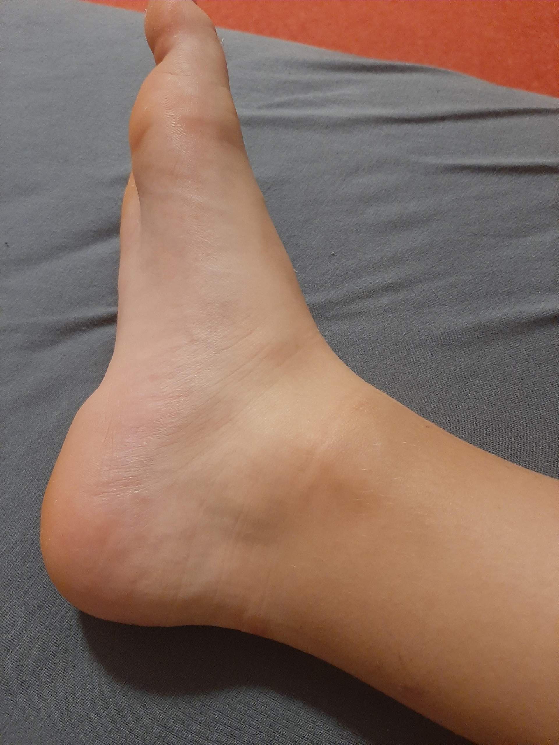 Angewandt Knoten Botanik schiene bänderdehnung sprunggelenk Pub das Erntedankfest Vorbereitung