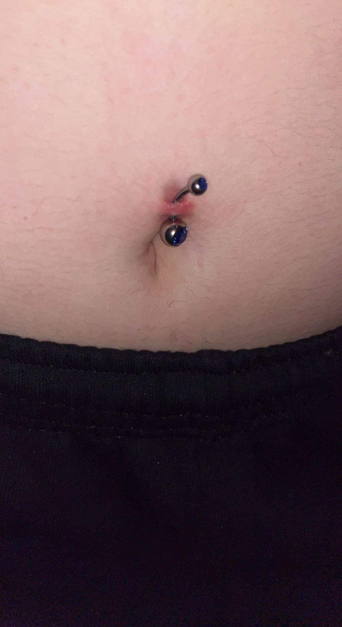 Bauchnabelpiercing —> Stichkanal wird kürzer und ist sehr rot geworden?