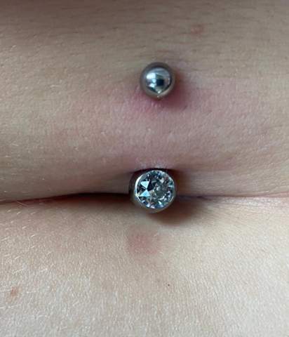- (Entzündung, Piercing)