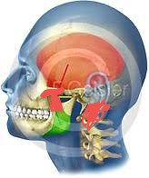 Benommenheit Wahrnehmungstorungen Etc Von Der Hws Benommenheit Wahrnehmungstorungen Etc Von Der Hws