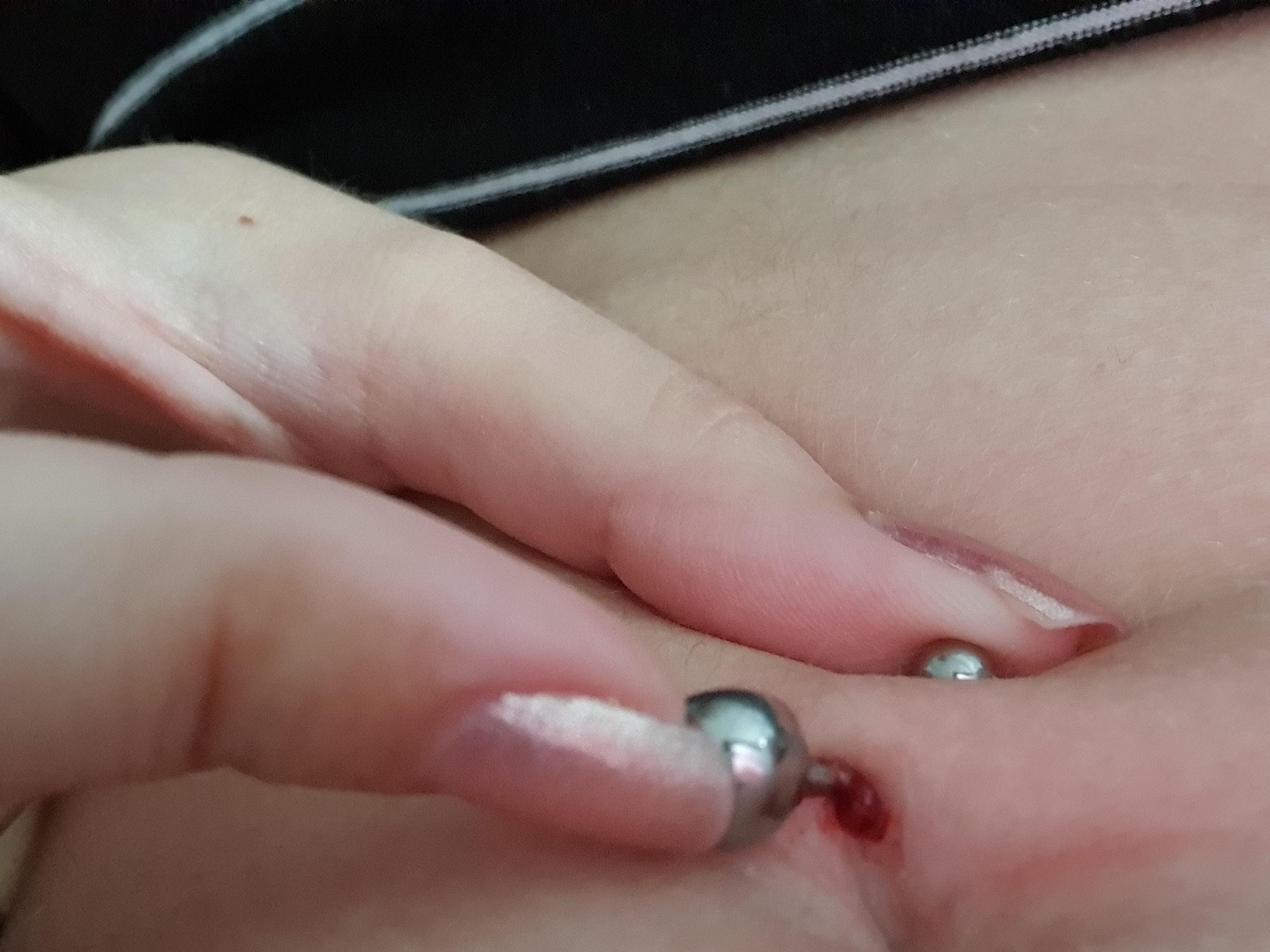 Blut Aus Bauchnabelpiercing Was Nun Arzt Blut Aus Bauchnabelpiercing Was Nun Arzt