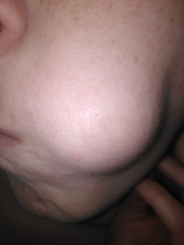 - (Haut, Medizin, Dermatologie)