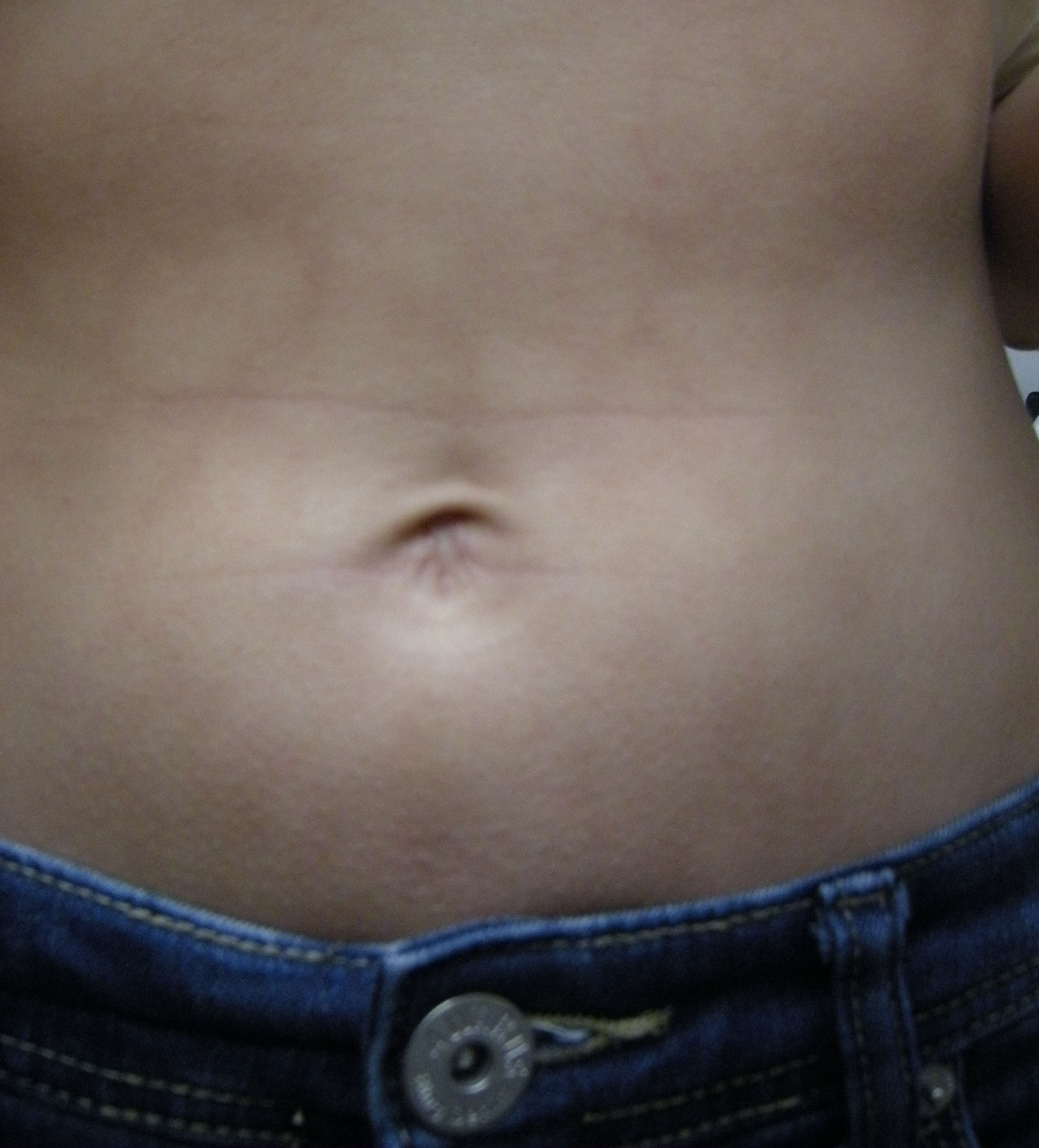 Welltox die Creme von den Pigmentflecken zu kaufen,