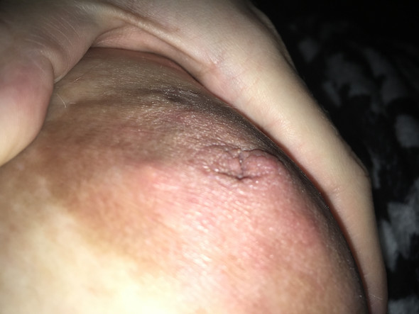 - (Schwangerschaft, Brust, Warzen)