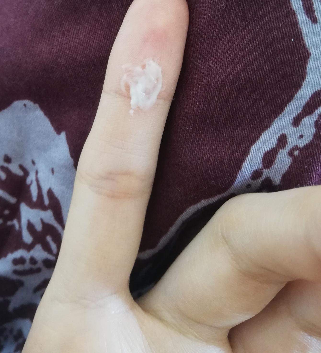 Dauernd Weisser Schleim Im Mund Zahne Zahnarzt Zunge Dauernd Weisser Schleim Im Mund Zahne Zahnarzt Zunge