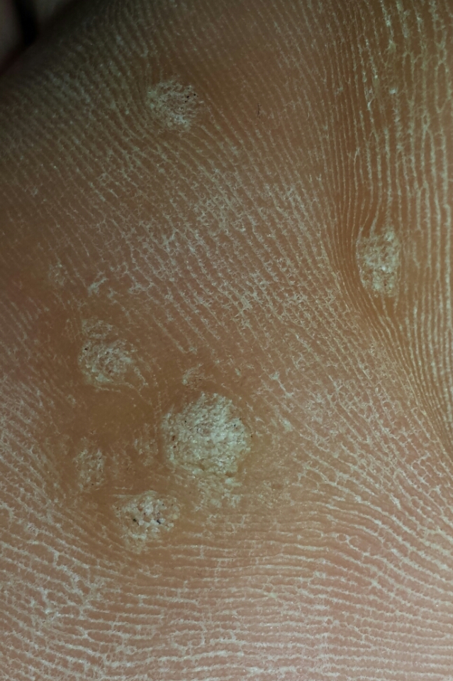 Noch fragen Noch fragen