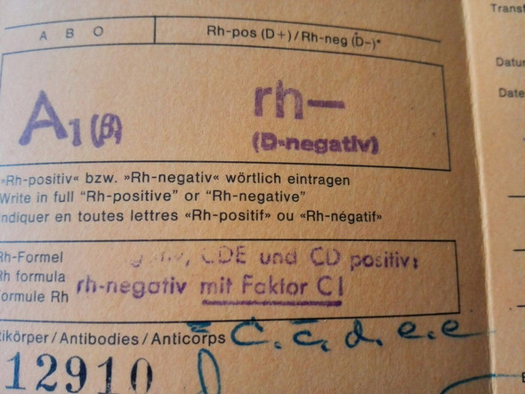 Eltern Rhesusfaktor Negativ Und Kind Trotzdem Positiv Geht Das Vererbung Blutgruppe Eltern Rhesusfaktor Negativ Und Kind Trotzdem Positiv Geht Das Vererbung Blutgruppe