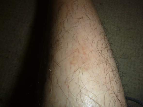 Ernstes Problem mit der Haut?
