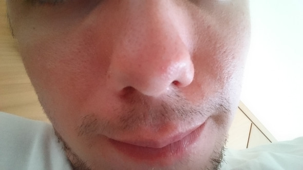 H1 - (Dermatologie, hautarzt, trockene Haut)