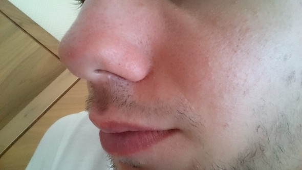 H2 - (Dermatologie, hautarzt, trockene Haut)