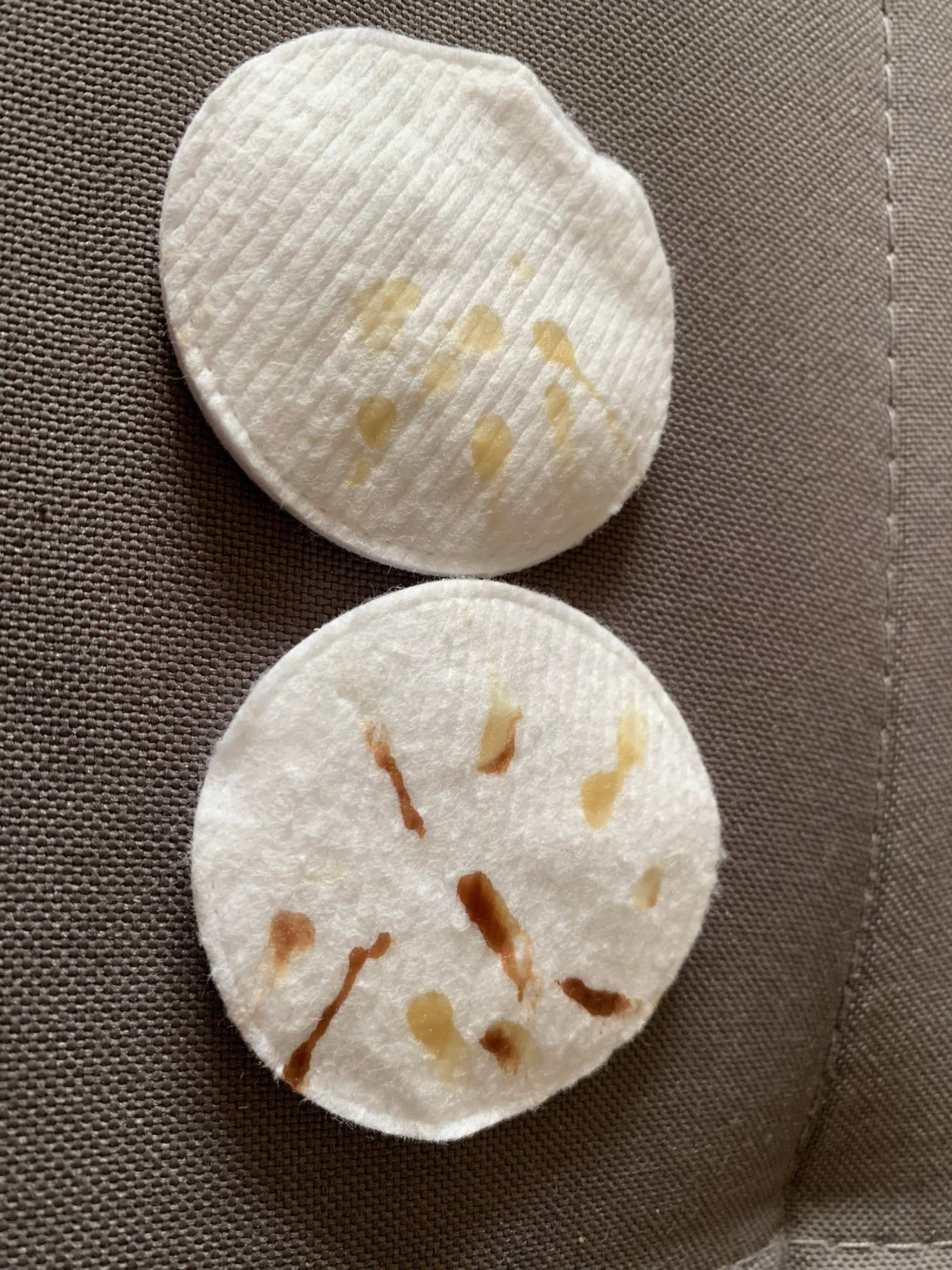 Flüssigkeit aus Brustwarzen sollte ich dringend zum Arzt? (Haut, Brust, Frauenarzt) Flüssigkeit aus Brustwarzen sollte ich dringend zum Arzt? (Haut, Brust, Frauenarzt)