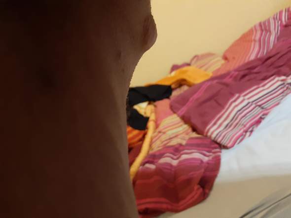 - (Haut, Medizin)