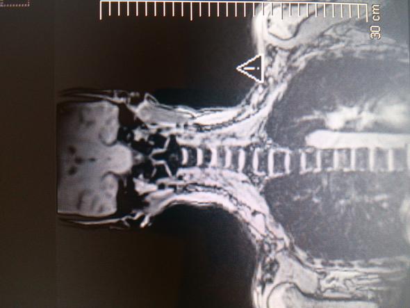 MRI - (Muskeln, Untersuchung, Knochen)