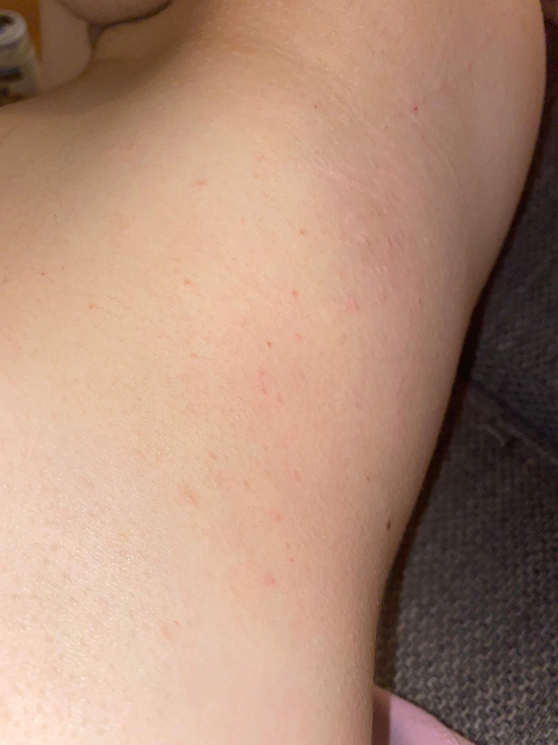 Starker Juckreiz Am Korper Was Tun Starker Juckreiz Am Korper Was Tun