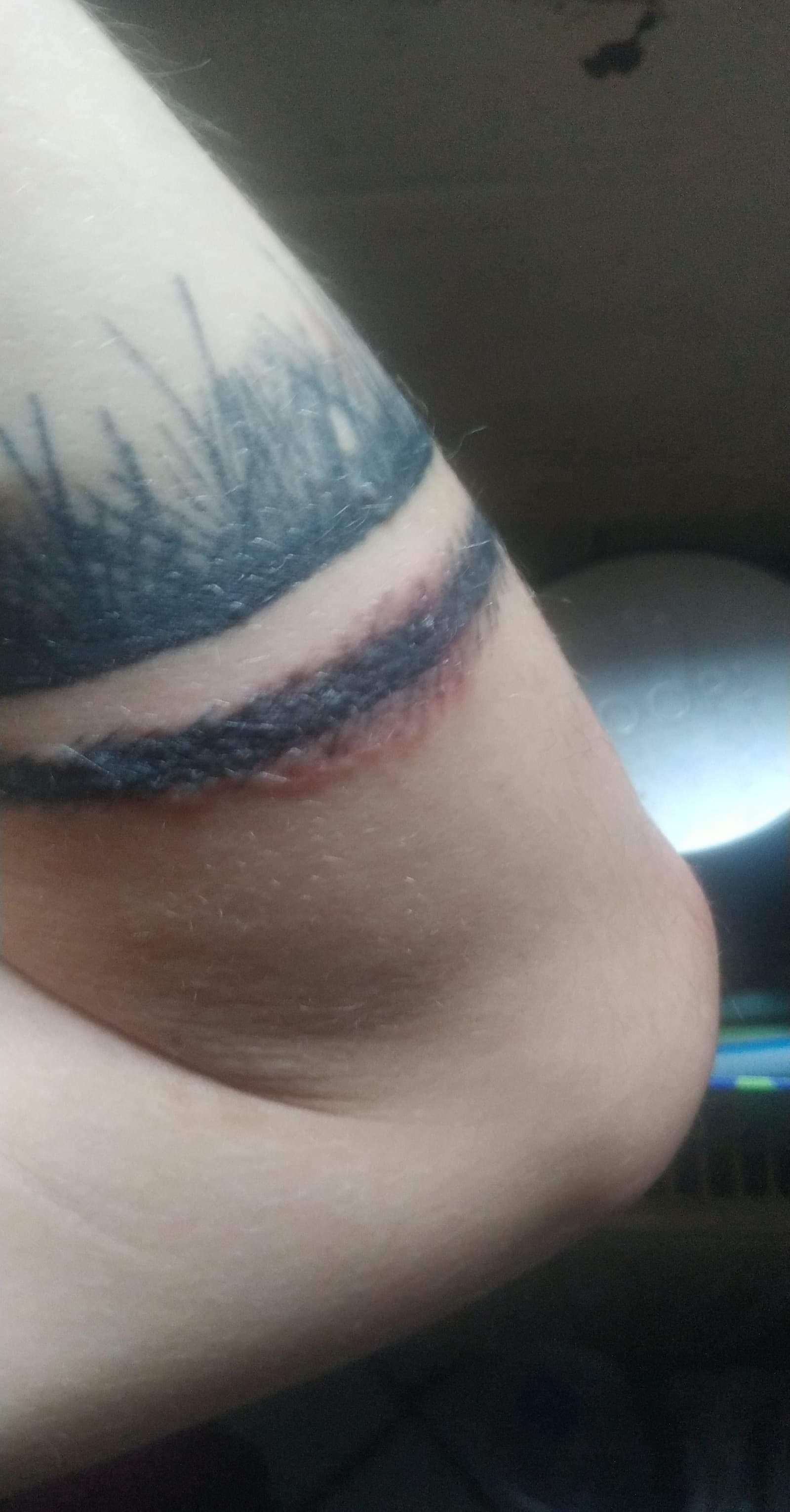 Frisches Tattoo Zwei Wochen alt juckt und Pusteln an manche Stellen