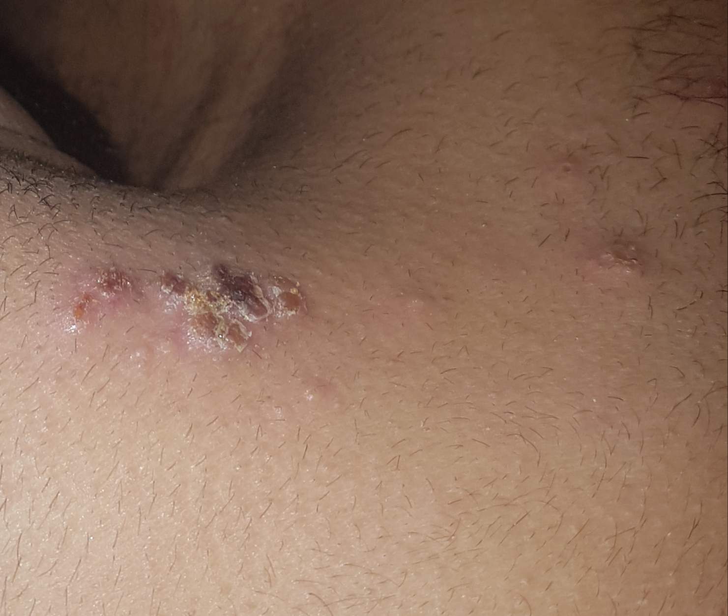 Rbsddhg6hpgs M Rbsddhg6hpgs M