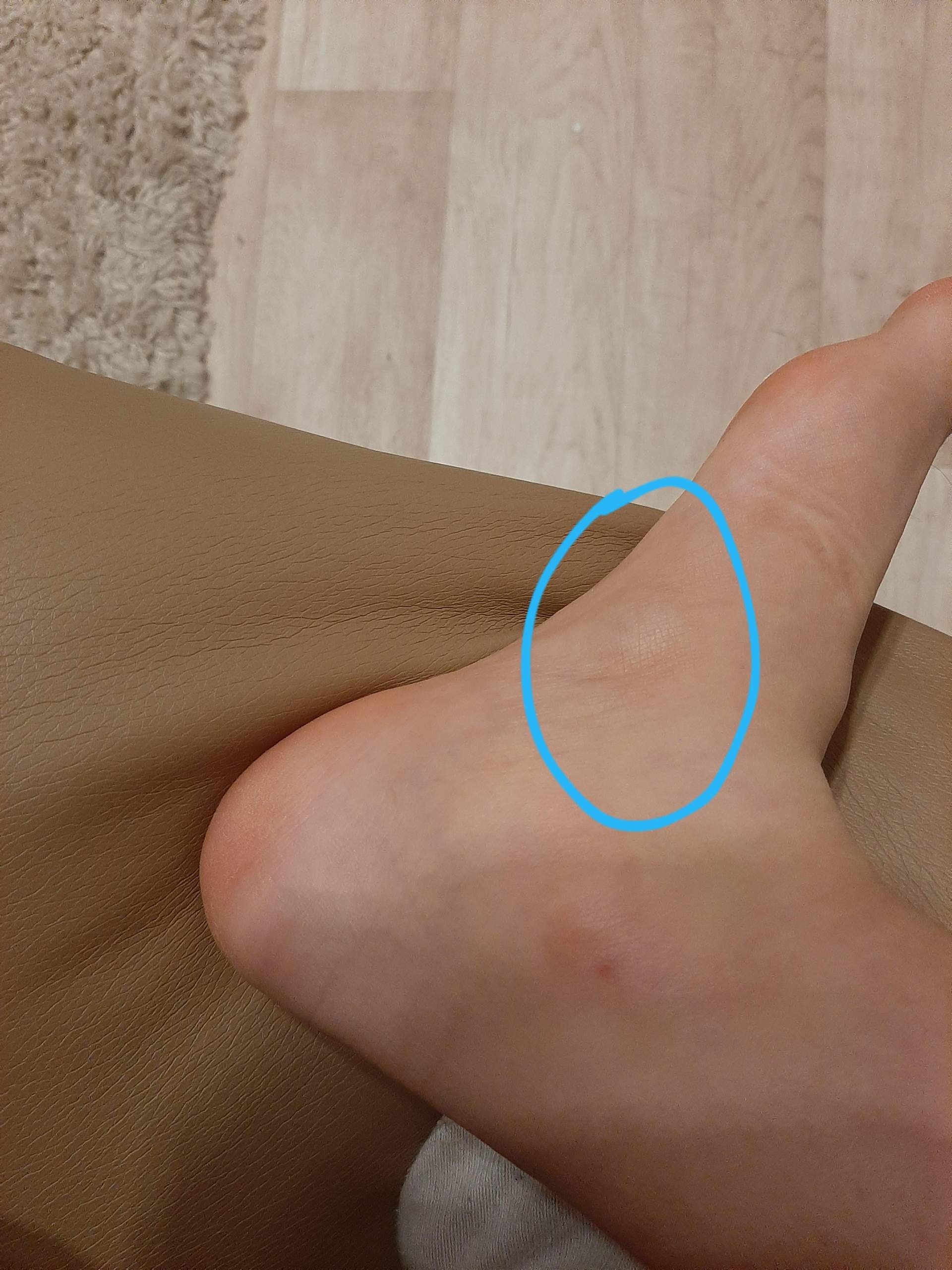 Alle Der Uberbein Fuss Entfernen Lassen Alle Der Uberbein Fuss Entfernen Lassen