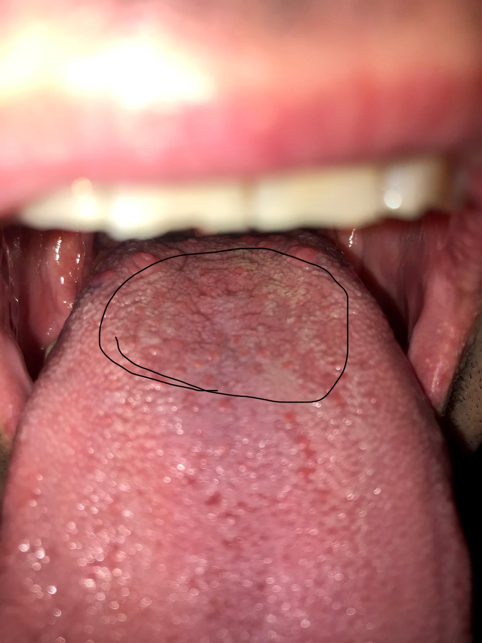 Gefühl wie ein Haar auf der Zunge?