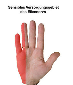 Betroffener Bereich - (Hand, Nerven, Taubheitsgefühl)