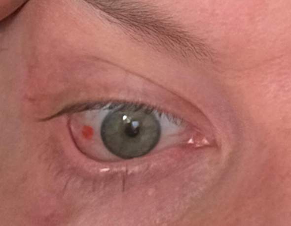 Bild zum Beitrag