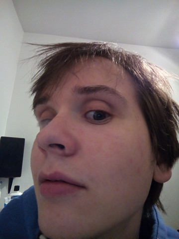 Gerotete Haut Gesicht Rotung